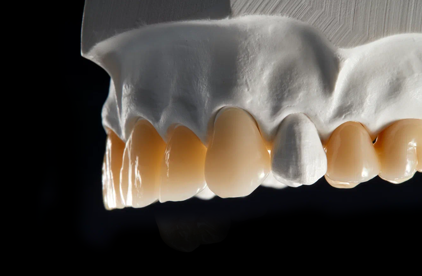 Multi-Layer Zirconia